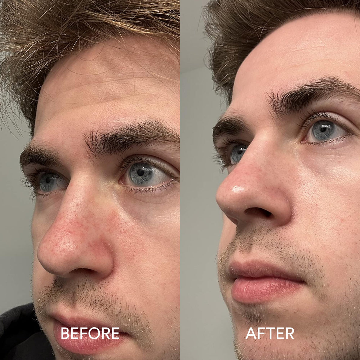 Dermazen serum staged beside shampoo to show routine compatibility