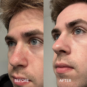 Dermazen serum staged beside shampoo to show routine compatibility