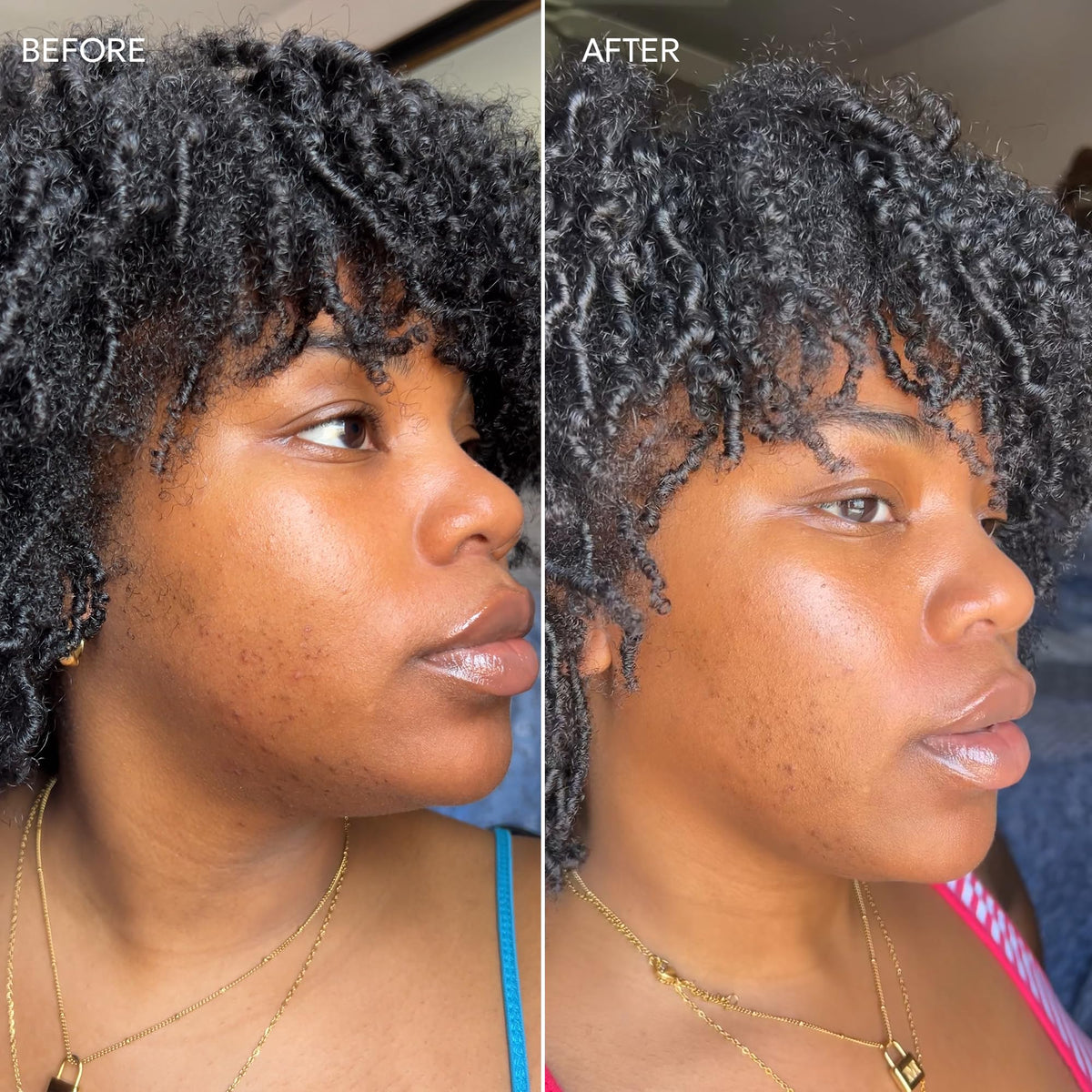 Dermisa applied on hand demonstrating quick absorption and hydration