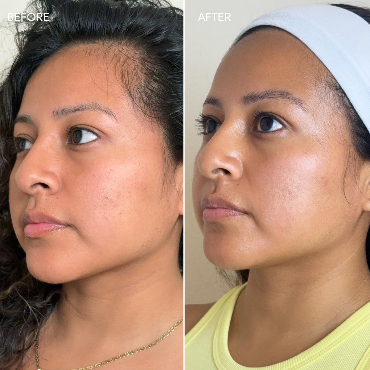 Dermisa label closeup highlighting active ingredients and clean formula