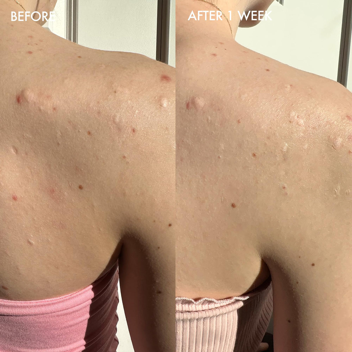 Dermisa sulfur bar in hand demonstrating gentle cleansing action
