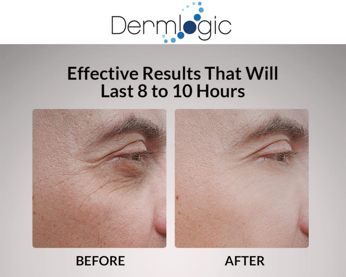Dermlogic before and after split view showing reduced puffiness