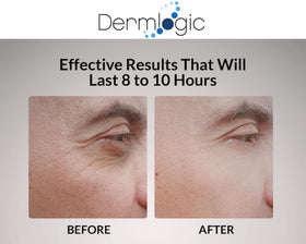 Dermlogic before and after split view showing reduced puffiness