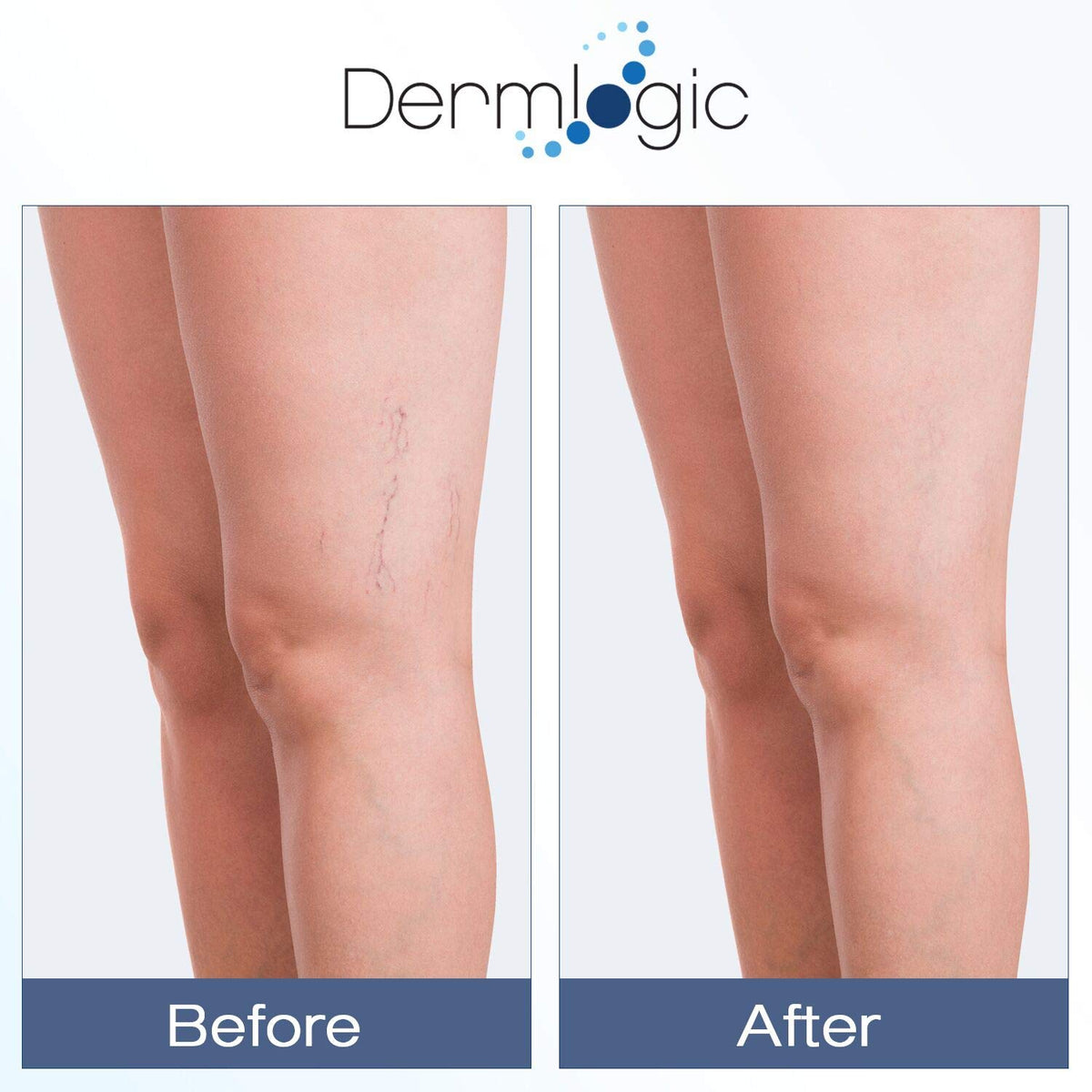 Dermlogic ingredient label highlighting vitamin K, arnica, hyaluronic acid benefits