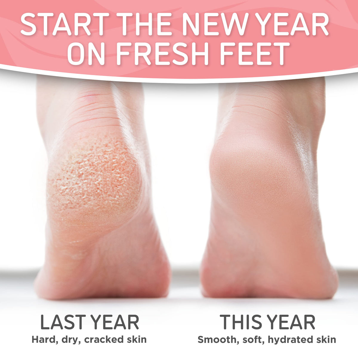 Dermora after peel showing smooth heels and soft skin for visible transformation benefit