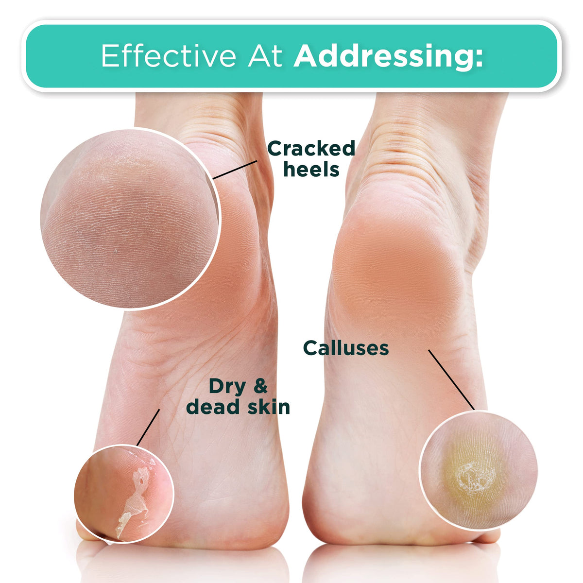 DERMORA bootie on foot in use illustrating hands-free application and relaxing at-home treatment