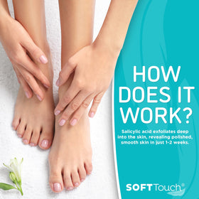Dermora before and after feet comparison showing reduced calluses benefit
