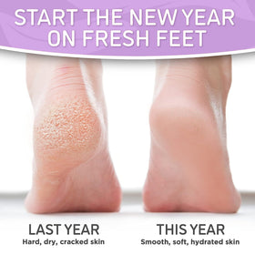 Dermora mask applied on feet demonstrating comfortable wear and hands-free treatment