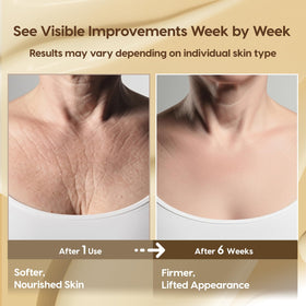 DERPHEA cream being gently smoothed on neck for firmer-looking, hydrated skin