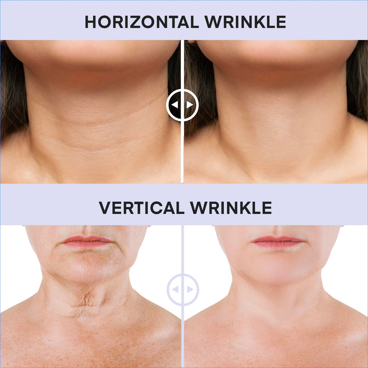 DERPHEA lifestyle shot on décolleté showing natural-looking hydration benefit
