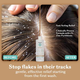 DHS zinc shampoo foamy lather texture demonstrating gentle cleansing benefit