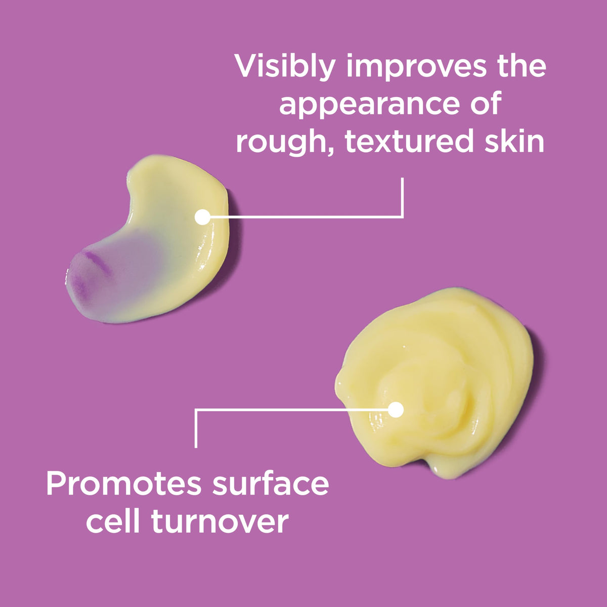 Differin being applied to cheek targeting a spot for improved texture