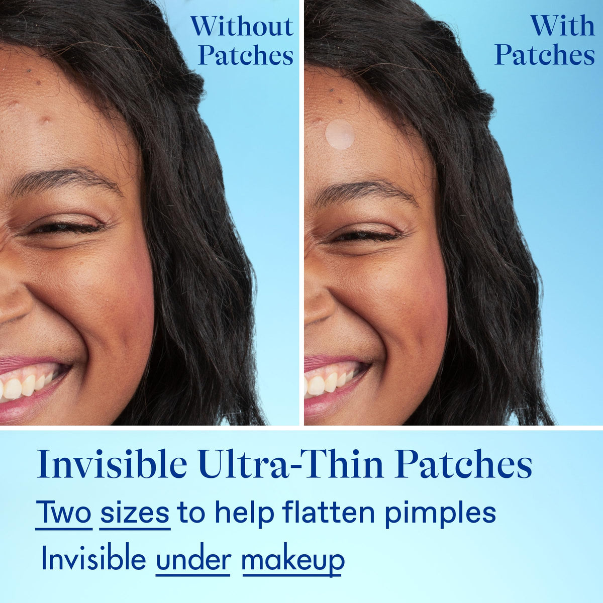 Differin conceptual before and after images suggesting clearer skin benefit