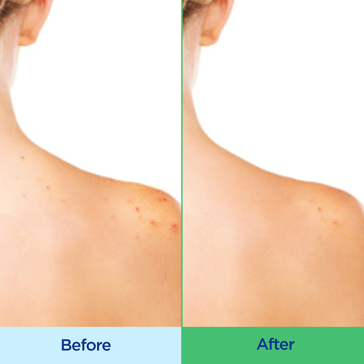 Differin cream-to-lather texture close-up for gentle cleanse benefit