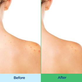 Differin cream-to-lather texture close-up for gentle cleanse benefit