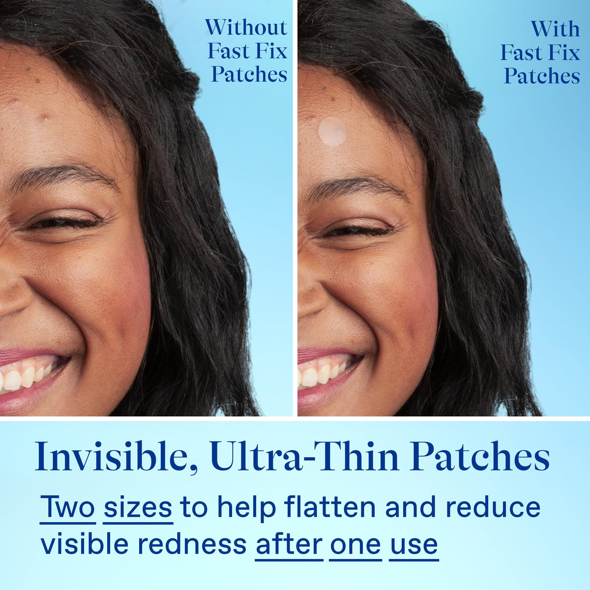 Differin ingredients label highlighting centella and niacinamide benefits