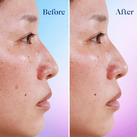 Differin serum layered under makeup for invisible finish benefit