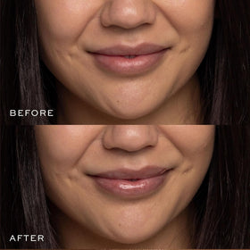DIME before and after lip comparison showing smoother, fuller-looking lips