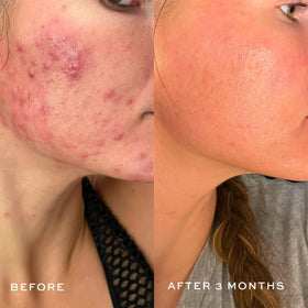 DIME cleanser staged on bathroom counter with towel, shows routine-ready benefit