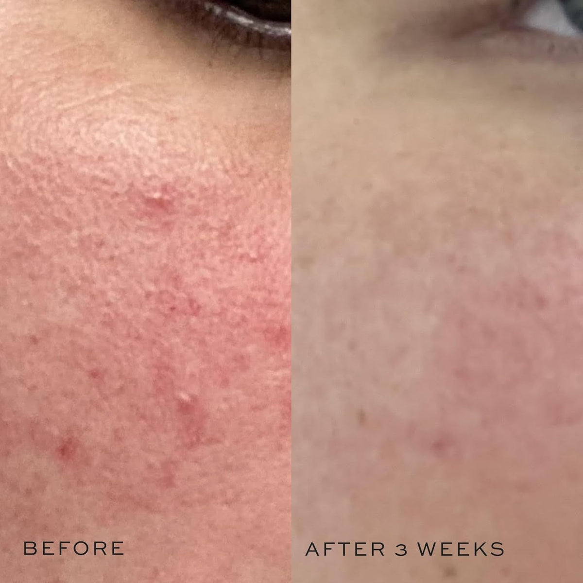 DIME cucumber extract visual conveying soothing and cooling benefit