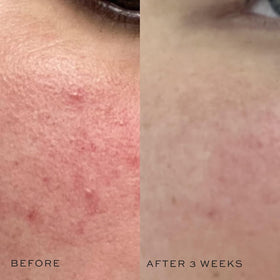 DIME cucumber extract visual conveying soothing and cooling benefit