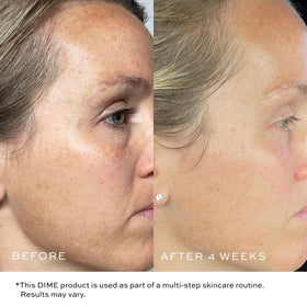 DIME TBT Cream with bakuchiol plant focus showing natural retinol alternative benefit