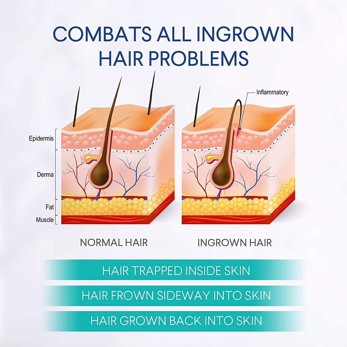 Dinocook applied to bikini area demonstrating gentle post-shave care