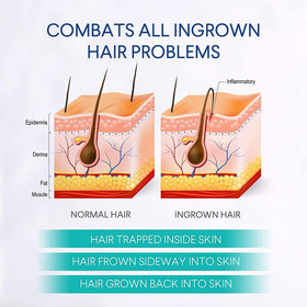 Dinocook applied to bikini area demonstrating gentle post-shave care