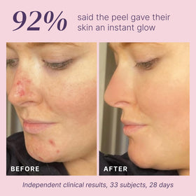 Divine Derriere before and after texture patch showing smoother skin benefit