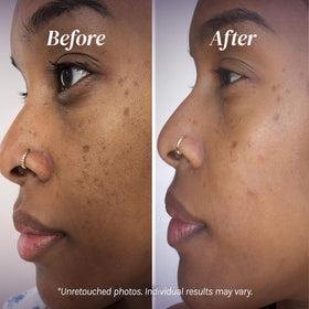Divine Derriere key ingredients with mulberry and kojic acid display