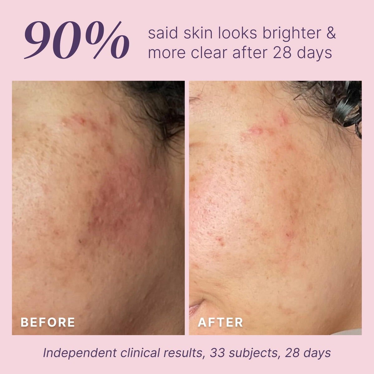 Divine Derriere small patch test on forearm demonstrating safe testing benefit