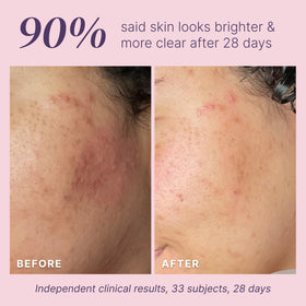 Divine Derriere small patch test on forearm demonstrating safe testing benefit