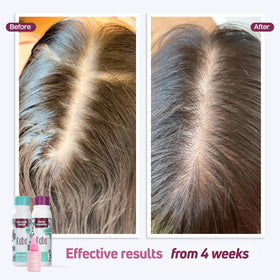 D'Luchi red onion shampoo bottle displayed upright for gentle cleansing and scalp clarity
