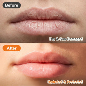 DMSKY lip balm in use at the beach demonstrating sun protection and outdoor convenience