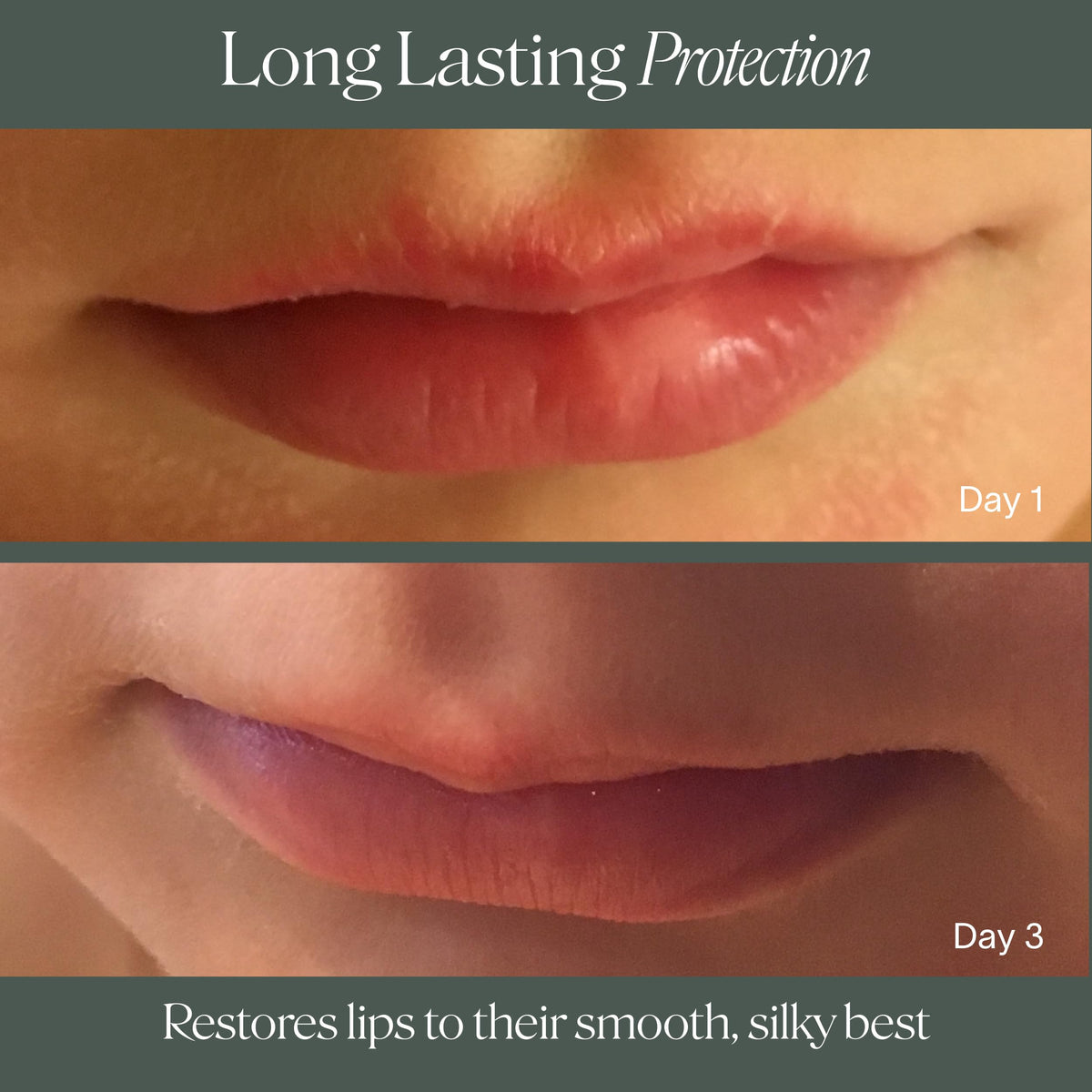 Doctor Rogers lip balm label close-up emphasizing fragrance-free, dermatologist-formulated benefit
