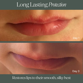Doctor Rogers lip balm label close-up emphasizing fragrance-free, dermatologist-formulated benefit