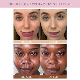 DOLL 10 before and after pore blur for visible texture softening