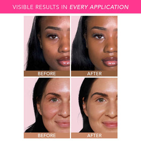 DOLL 10 before and after close-up showing reduced appearance of lines