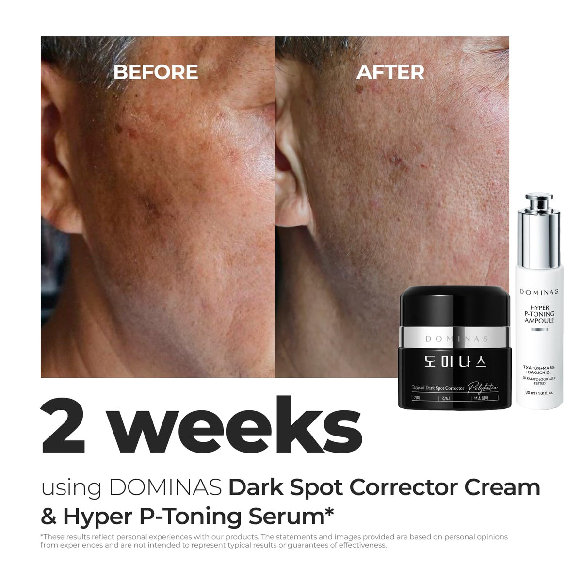 DOMINAS arranged active ingredients showing TXA and niacinamide benefits