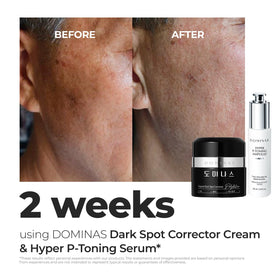 DOMINAS arranged active ingredients showing TXA and niacinamide benefits