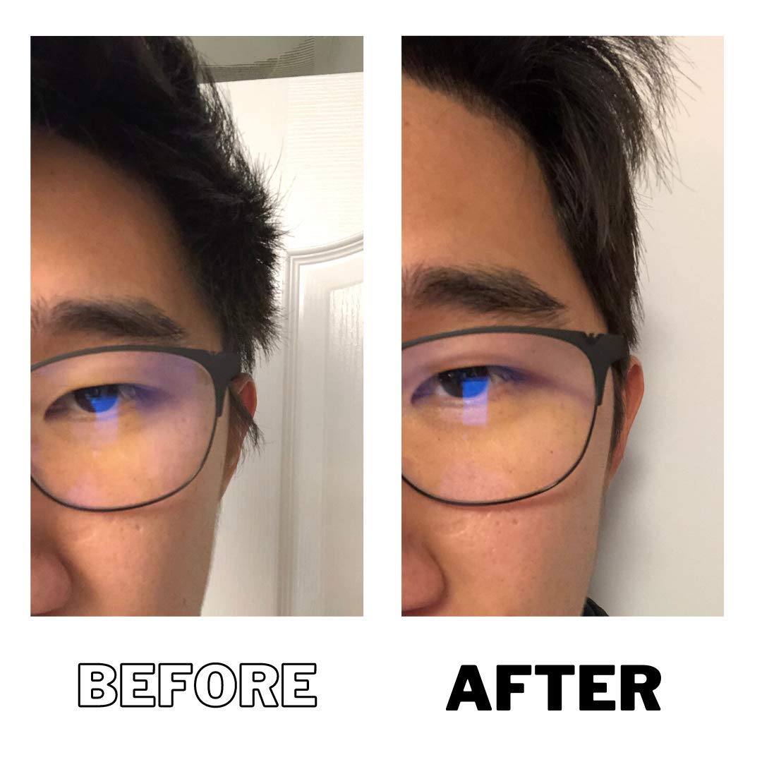 DPERM application in progress demonstrating professional technique