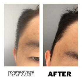 DPERM before and after comparison showcasing smoother hair