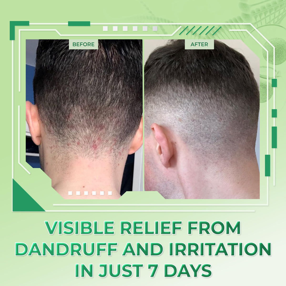 dr.atoskin shampoo in hand ready for scalp application benefit