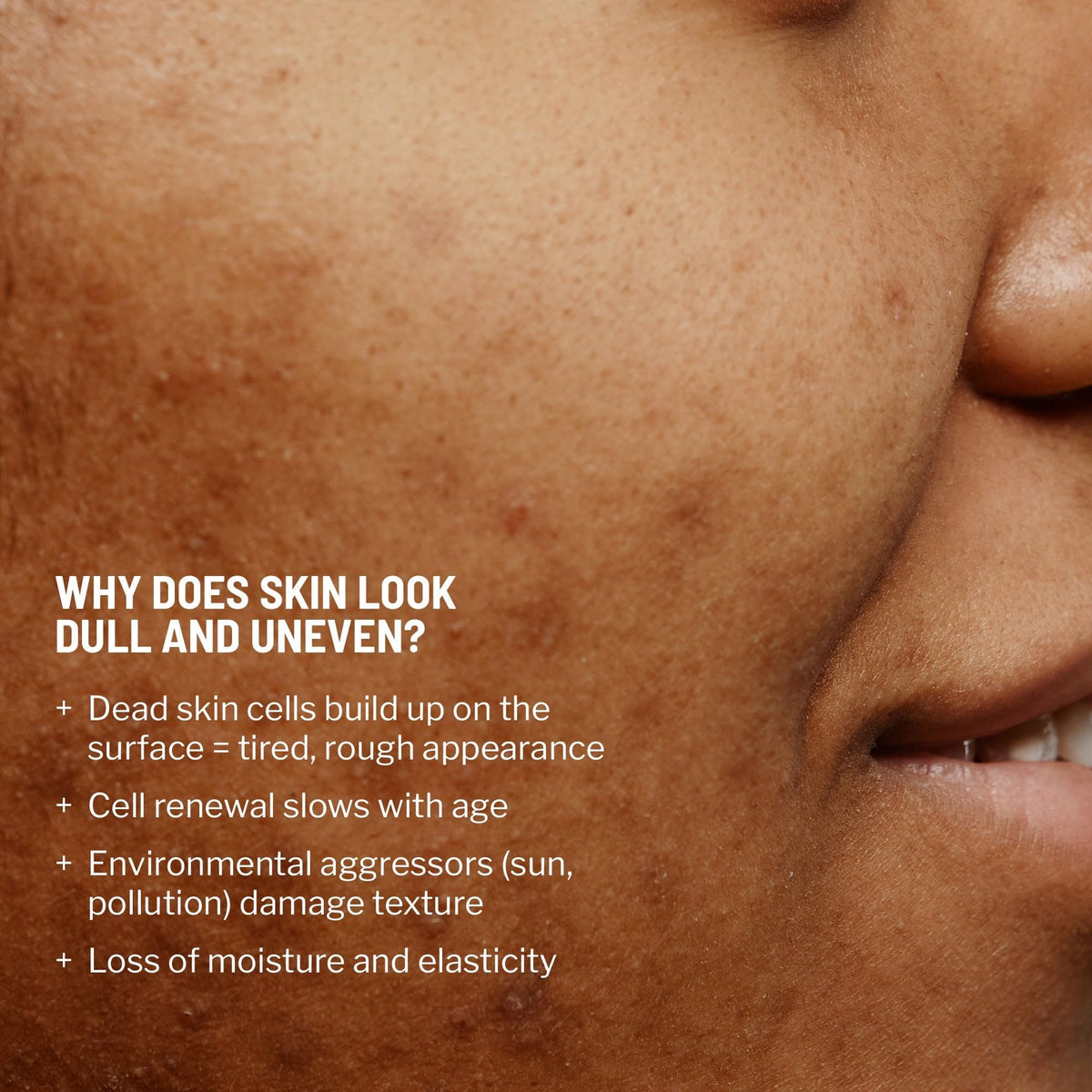Dr. Brandt applied to hand demonstrating smooth exfoliation and immediate glow