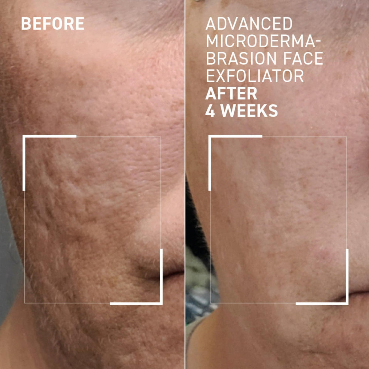 Dr. Brandt product with open cap showing creamy scrub for precise application