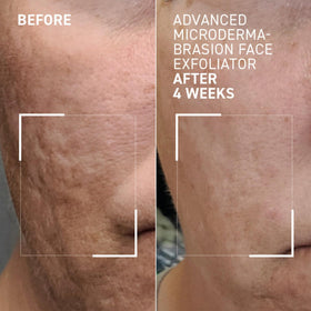 Dr. Brandt product with open cap showing creamy scrub for precise application