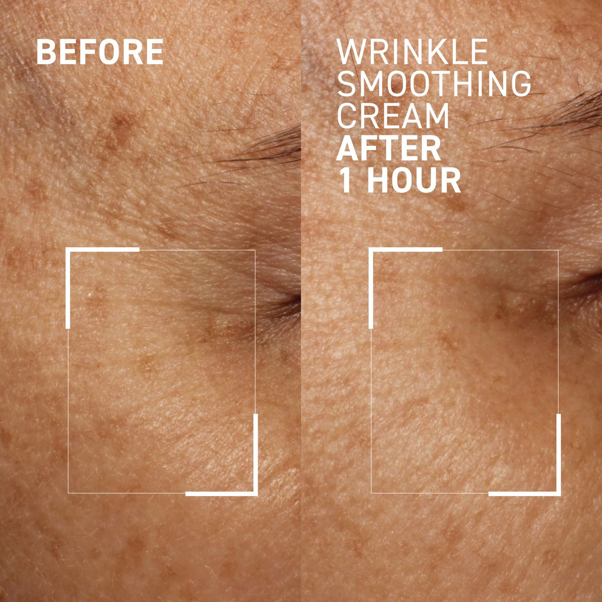 Dr. Brandt applying cream to forehead targeting expression lines effectively