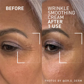 Dr. Brandt cream on fingertip ready for precise application and firming