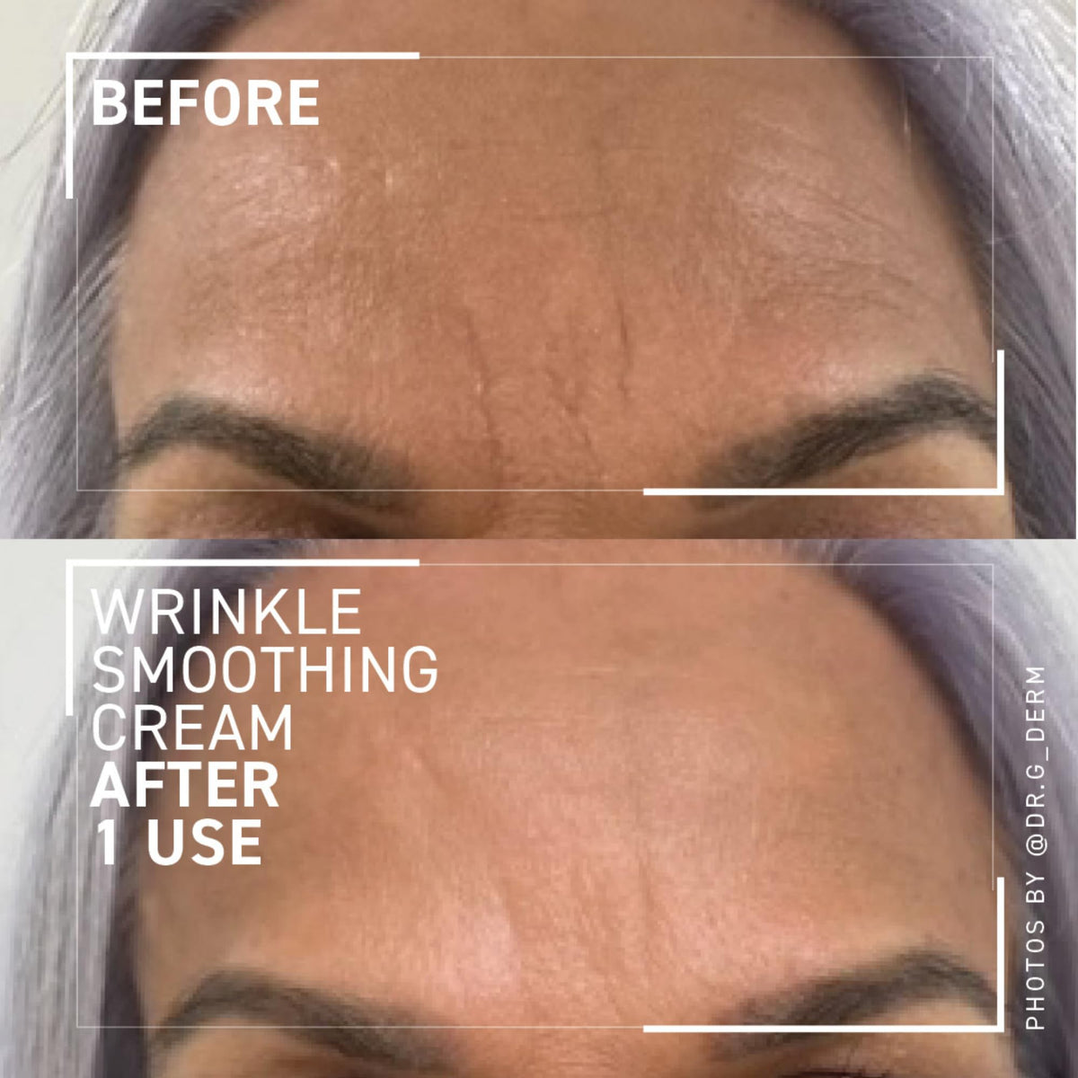 Dr. Brandt open jar close-up showing rich texture for targeted smoothing