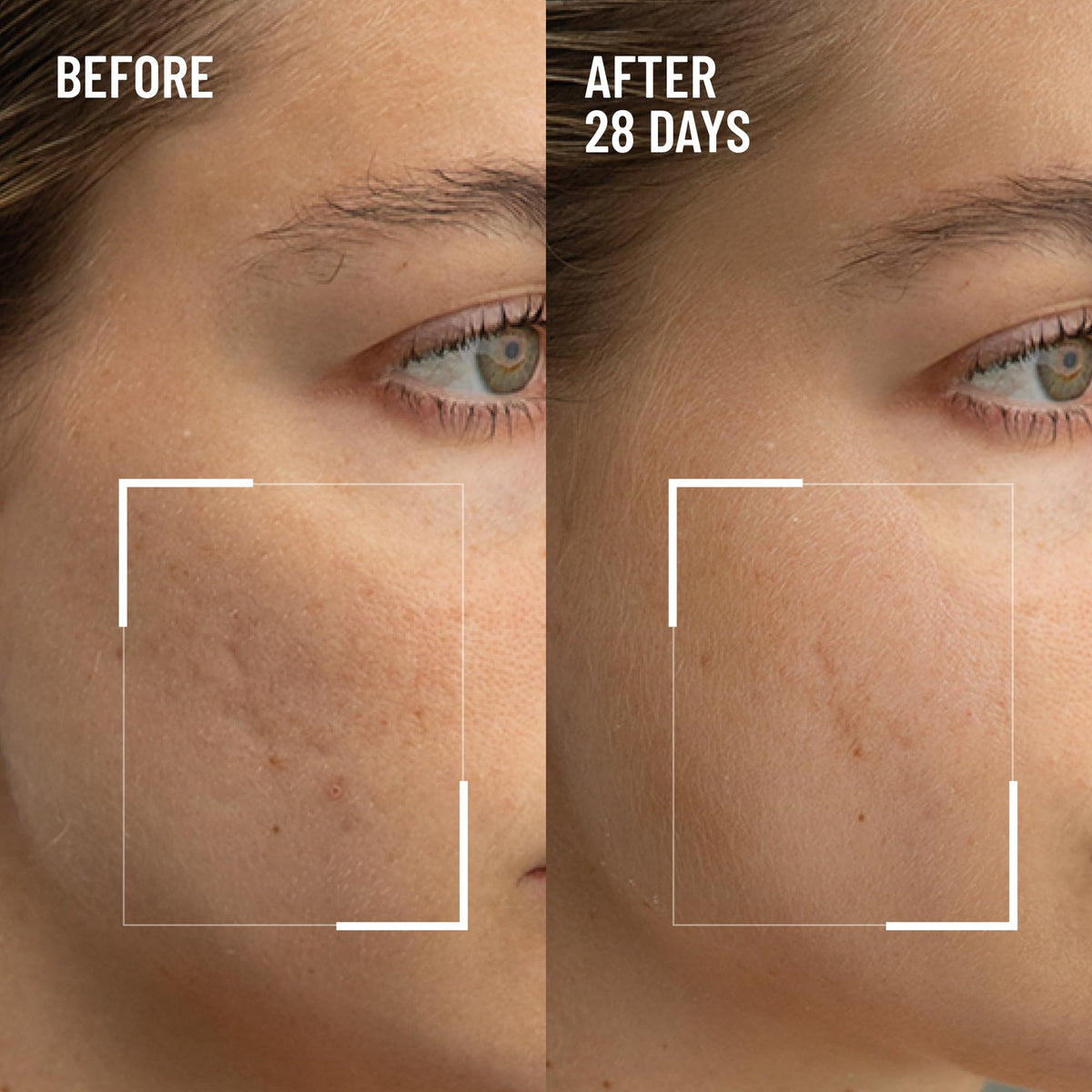 Dr. Brandt open jar showing creamy exfoliant texture and spreadability benefit